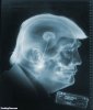 Trumps-XRay--131918.jpg