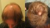 hair comparison.jpg