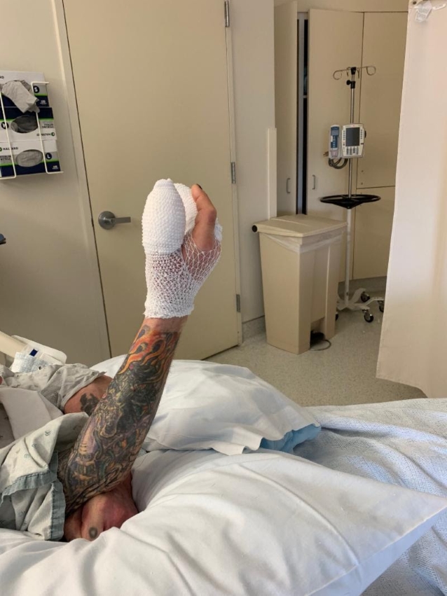 ozzyosbournehandsurgeryphotooct2018_638.jpg