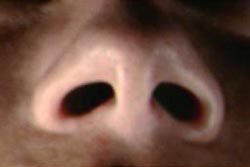 nose.jpg