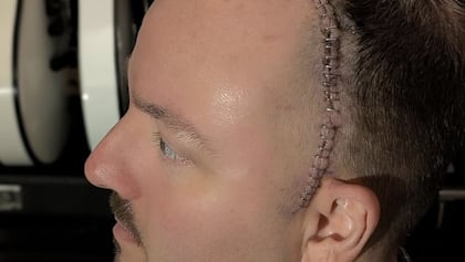 waynelozinakpostsurgeryaug2025_420x237.jpg