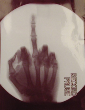 xrayfinger.jpg